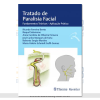 Tratado de Paralisia  Facial