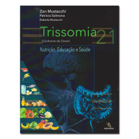 Trissomia 21 (Síndrome de Down)