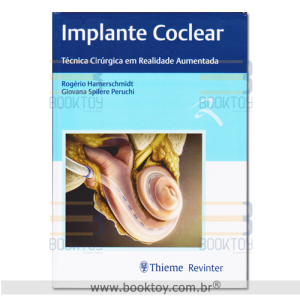 Implante Coclear Técnica Cirúrgica em Realidade Aumentada