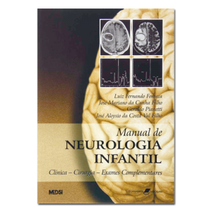 Manual de Neurologia Infantil (Clínica-Cirurgia-Exames Complementares) 