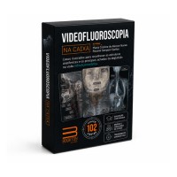 Videofluoroscopia Na Caixa